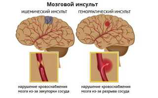 Как красное вино влияет на артериальное давление, повышает или понижает?