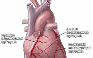 Коронарные артерии сердца, схема сосудов