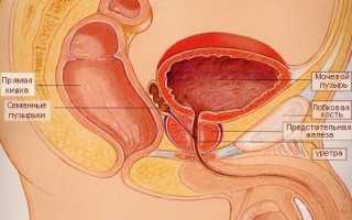 От чего появляется чувство зуда при воспалении простаты