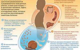 Глисты в моче мочевом пузыре у детей и взрослых