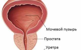 Схема приема Детралекс при воспаленной простате