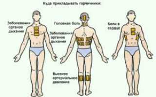 Как использовать горчичники при повышении давления