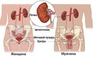 Что делать при появлении тошноты